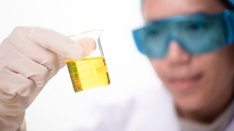 Wait, What’s in Our Pee Now?!