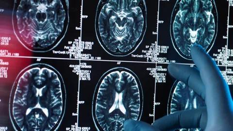 Music Might Be Your Brain’s Secret Weapon