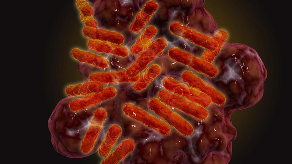 New Tick Disease in Dogs Could Hit Humans