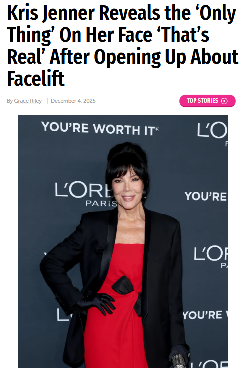 Kris Jenner’s Facelift Confession 😱