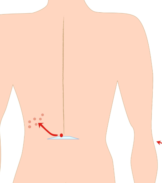 I just turned 38 and I have shingles...