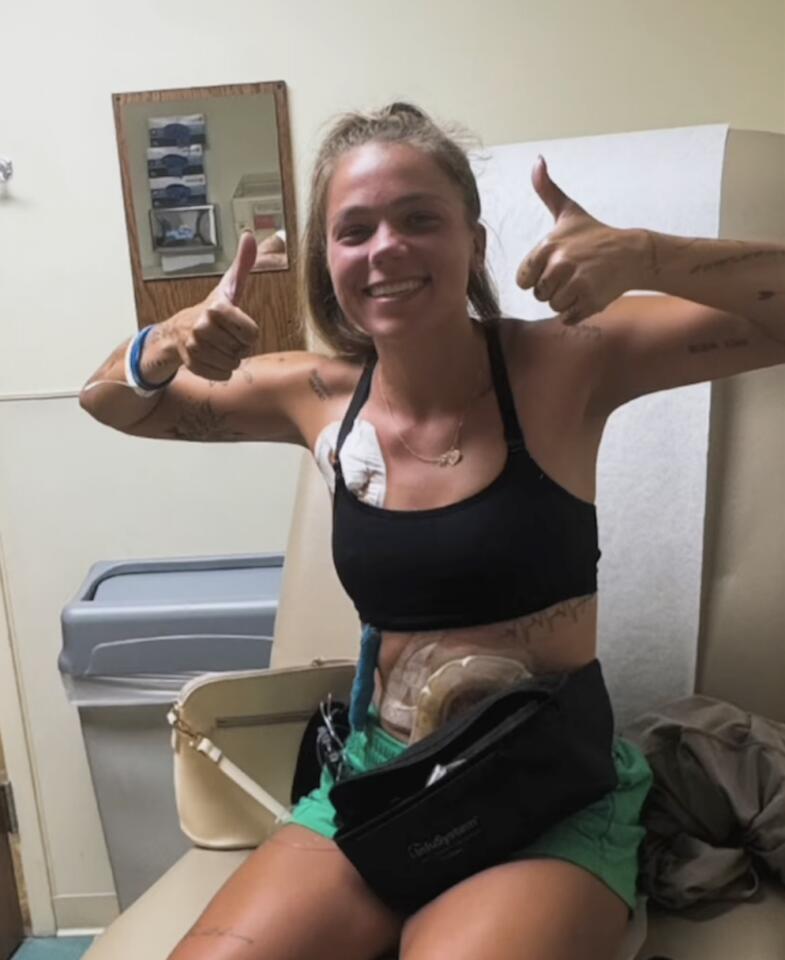 Cleveland runner beats colon cancer at 31