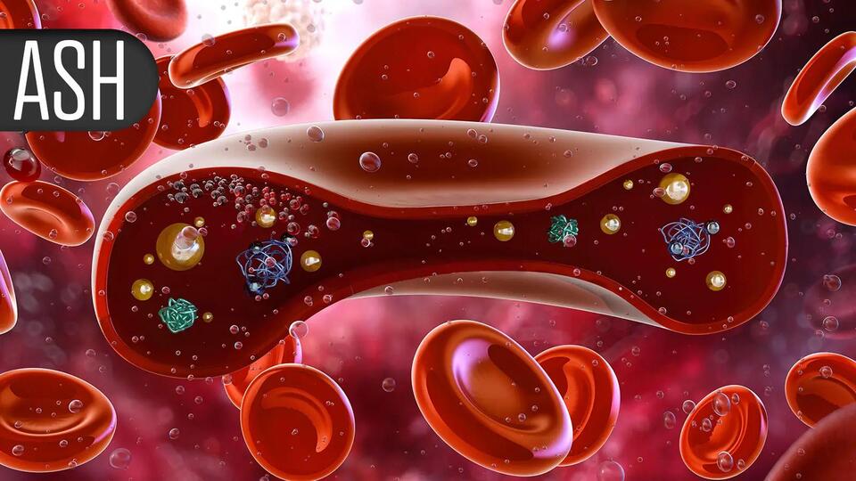 Breakthrough Combo for Tough Myeloma Cases