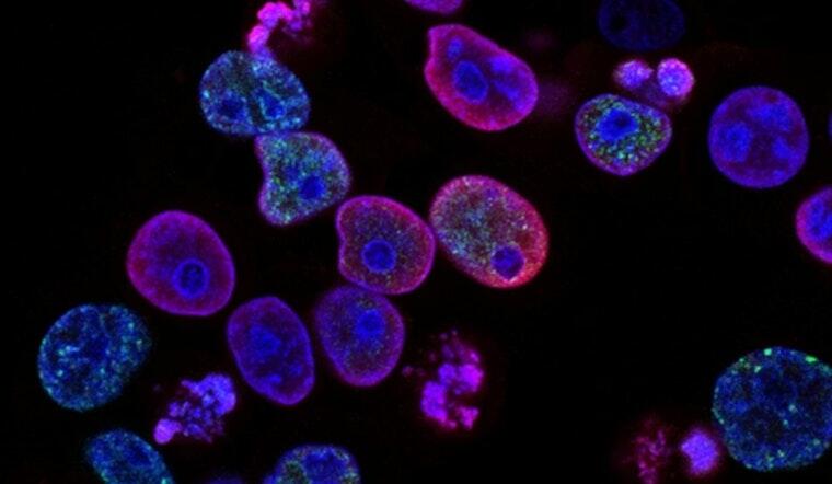 Blood Cancer Breakthroughs? UC’s Big Reveal